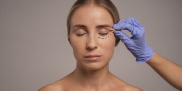 Blefaroplastia: dra. Lara El Andere é referência no Brasil em cirurgia que transforma o olhar