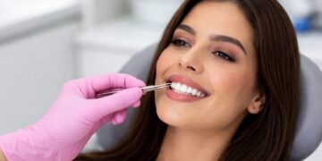 Lentes dentais viram febre entre famosos e cresce busca por facetas em resina no Brasil